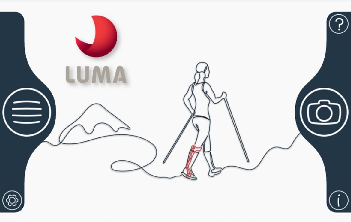 Revolutionizing Prosthetics and Orthotics with Luma
