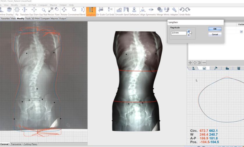 Canfit Design - Spinal Scan